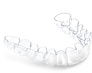 Clear plastic aligner trays fitted over the upper and lower teeth