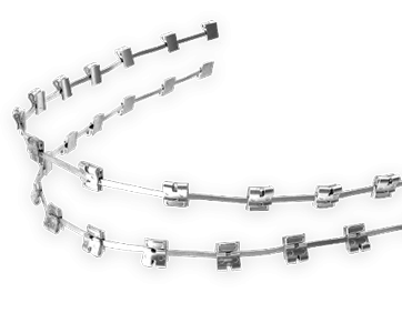 Traditional metal braces, with brackets fixed along an archwire