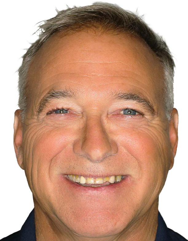 Happy-client-Before.png